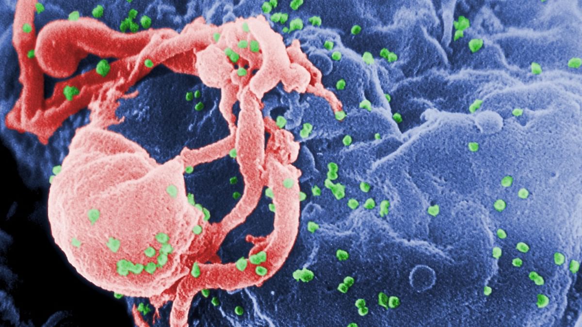Scientists identify second HIV patient whose body likely rid itself of virus