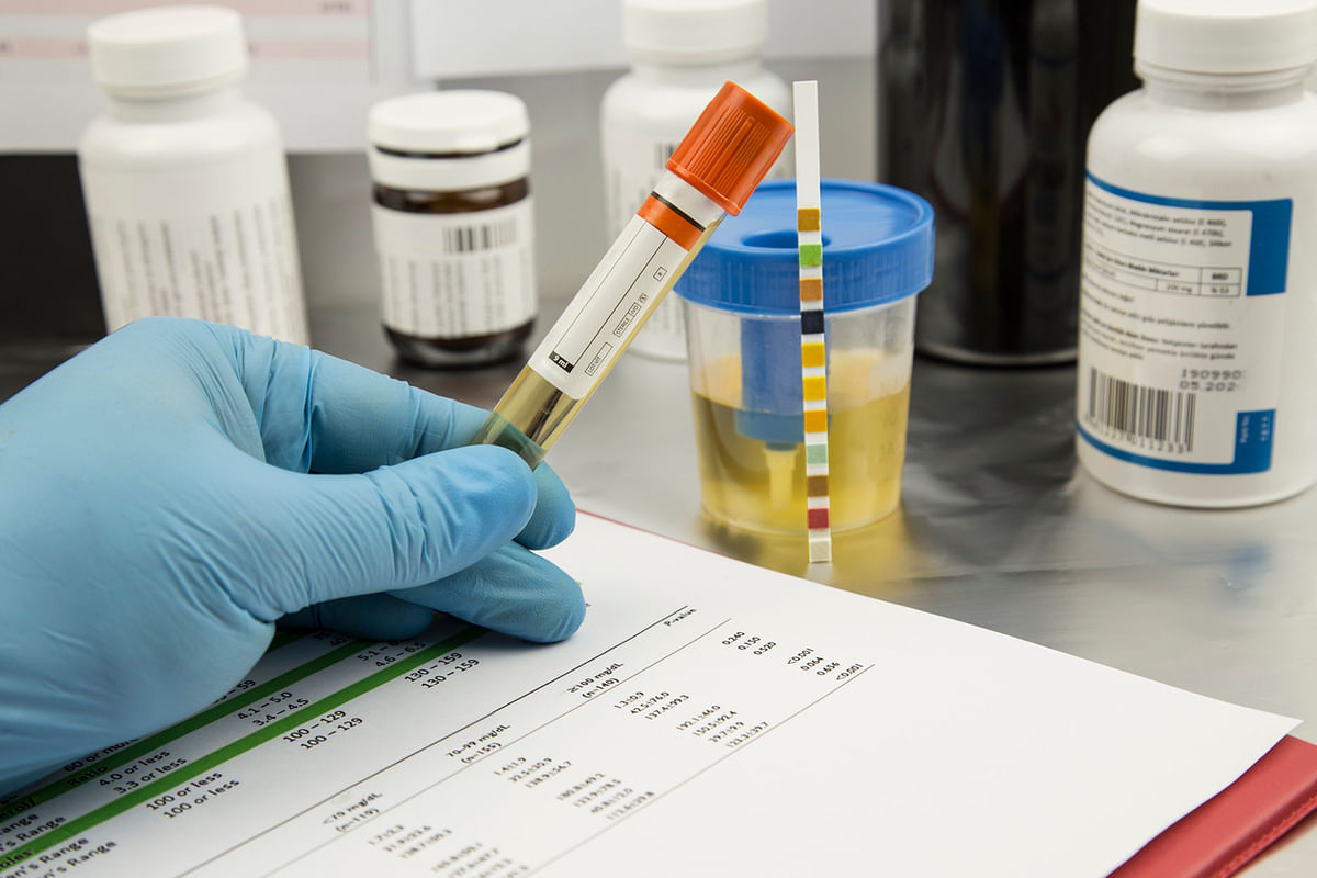 WADA reinstates accreditation of India's dope-testing laboratory