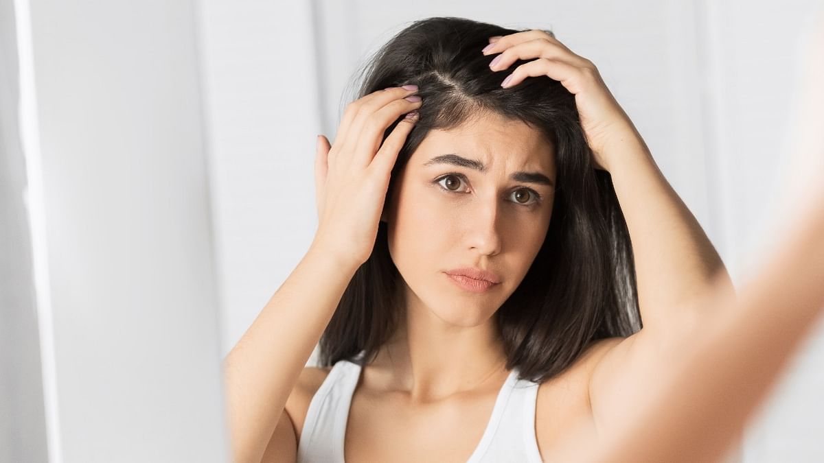 An itchy scalp? Tricks to drive away dandruff this winter
