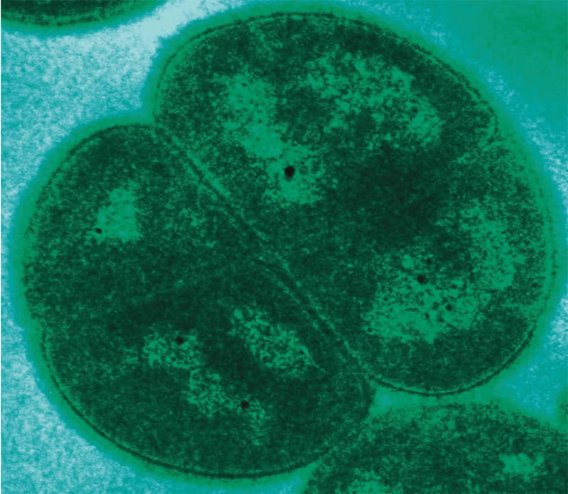 Deinococcus Radiodurans: The World's Toughest Bacterium. A Review