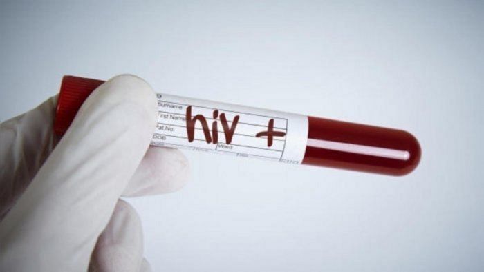 HIV diagnostics free in govt hospitals