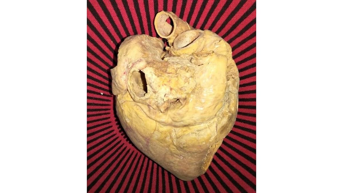 Plastinated heart to be donated to JSS Medical College
