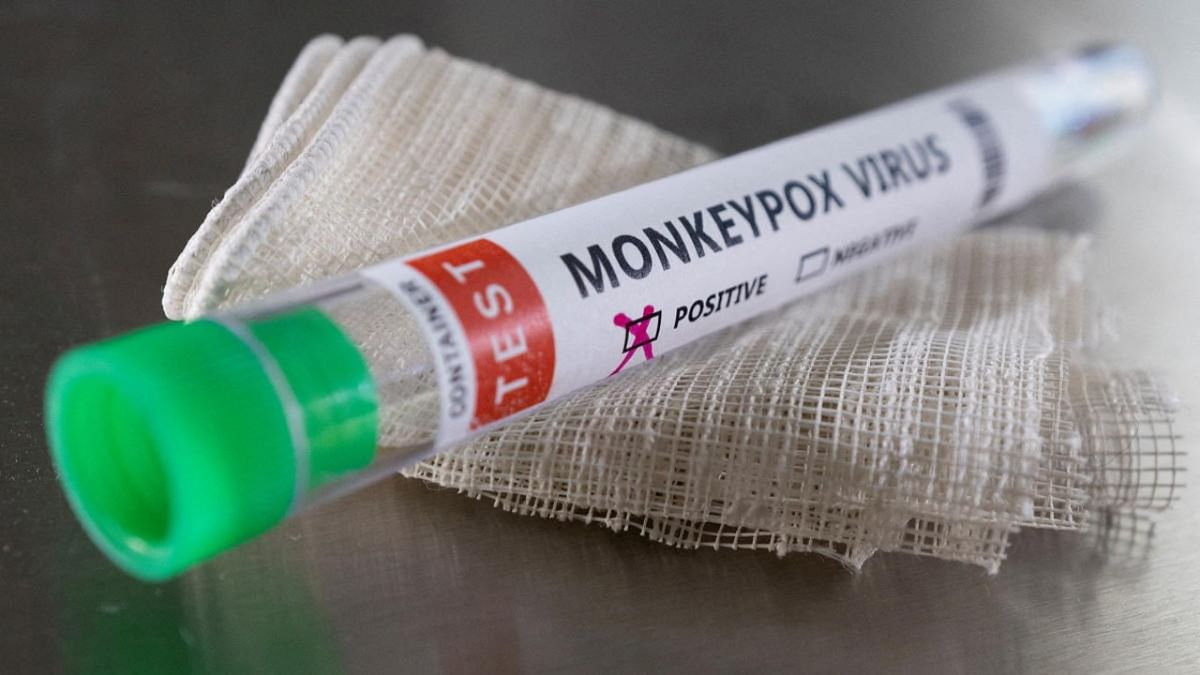 Monkeypox: Time for heightened alert