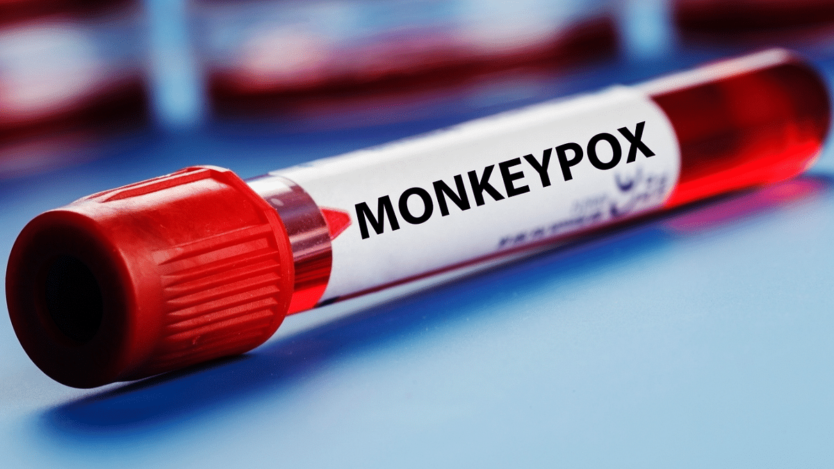 Maharashtra: Nine out of ten suspected monkeypox patients test negative, one result awaited
