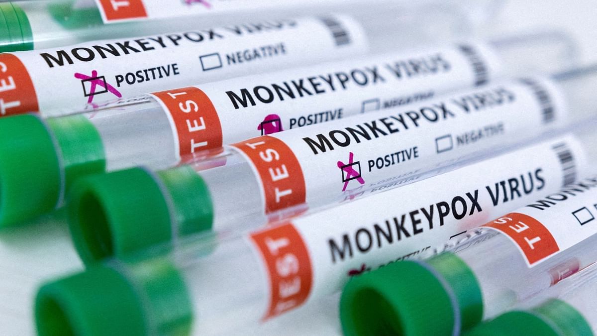 Health ministry releases dos and don'ts to prevent contracting monkeypox