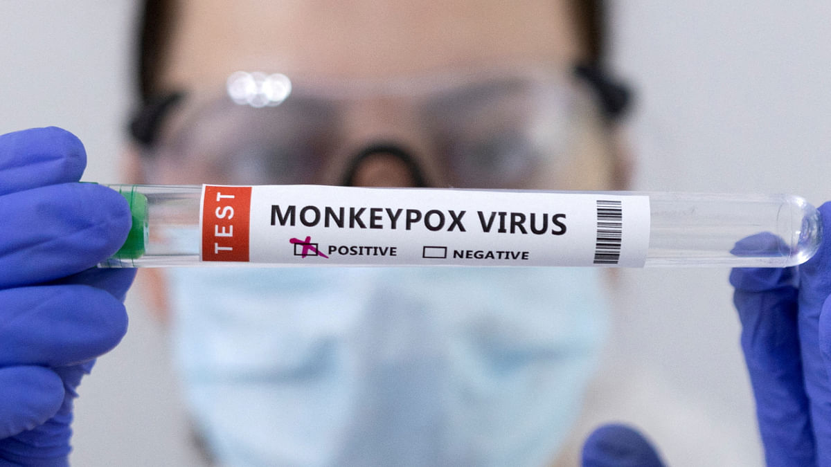 India is ramping up monkeypox testing amid rising infections: Here's how