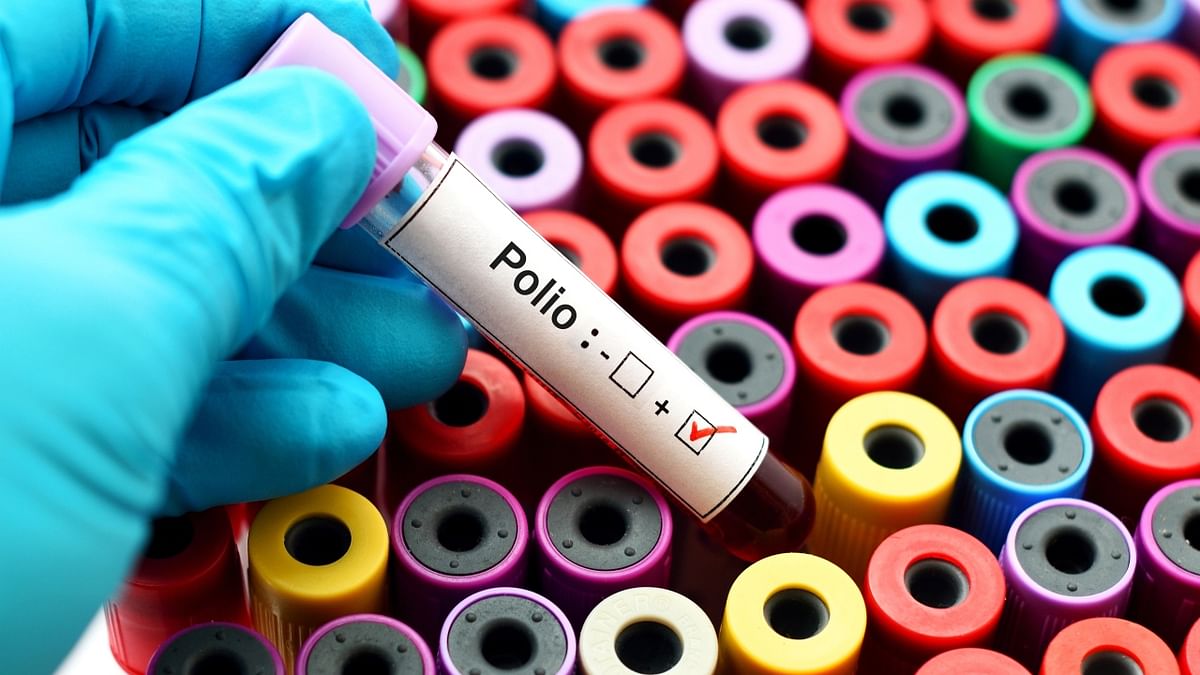 Polio virus found in New York City wastewater, suggesting local transmission