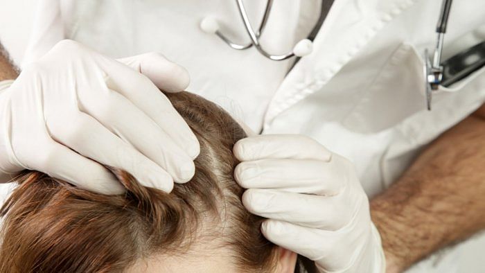 What to do if you’re experiencing hair loss after Covid-19