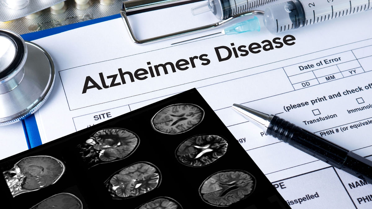 A 19-year-old is the youngest person to be diagnosed with Alzheimer’s disease – the cause is a mystery