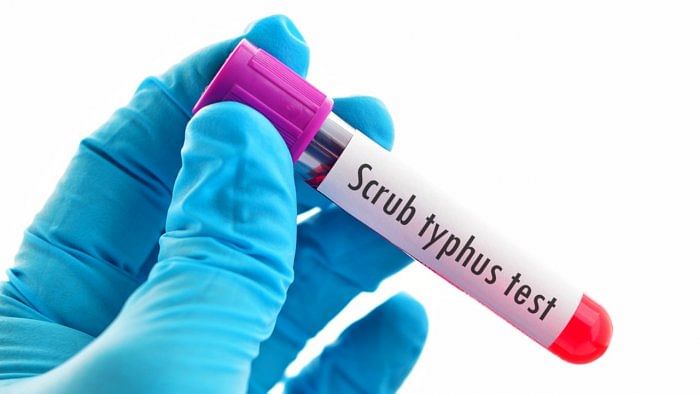 Explained | All about Scrub typhus, the infection killing people in Himachal, Rajasthan