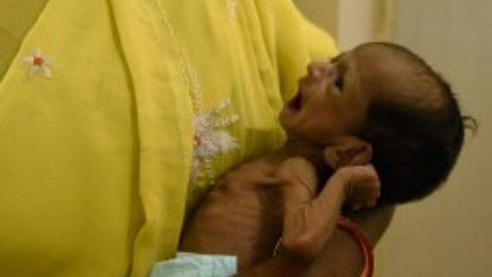 Gujarat has over 1.25 lakh malnourished children, tribal district Narmada tops the list