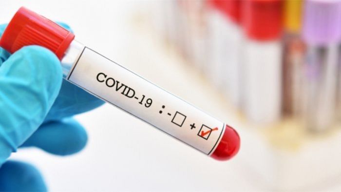 Active Covid cases in country dip to 15,515