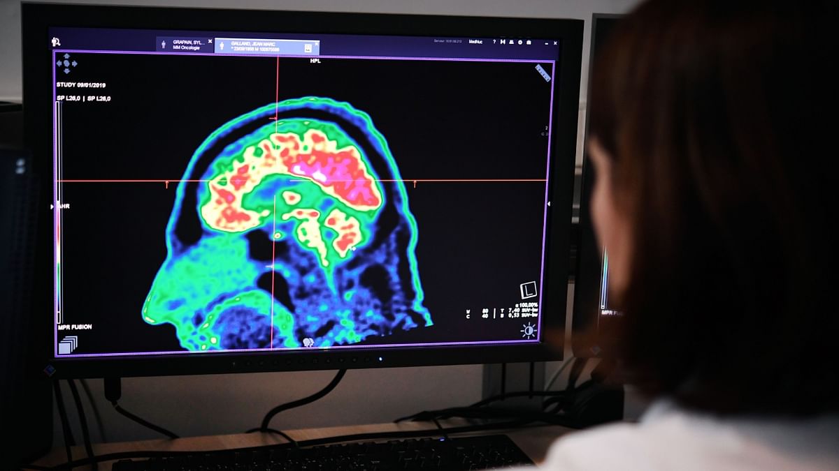 Scientists led by Indian make pathbreaking discovery that could improve lives of brain cancer patients