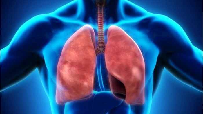 India could face third highest economic burden of COPD from 2020-50: Lancet Study
