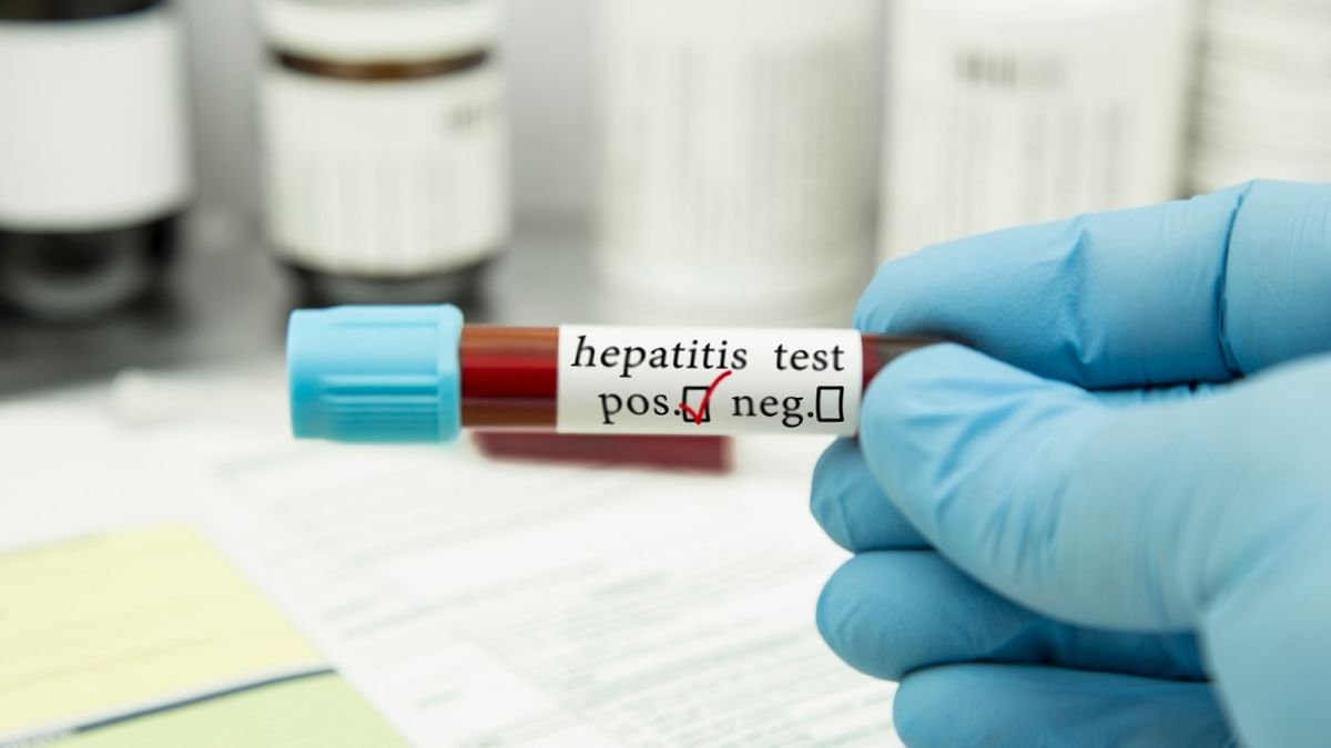 Odisha declares Hepatitis B and C as notifiable diseases