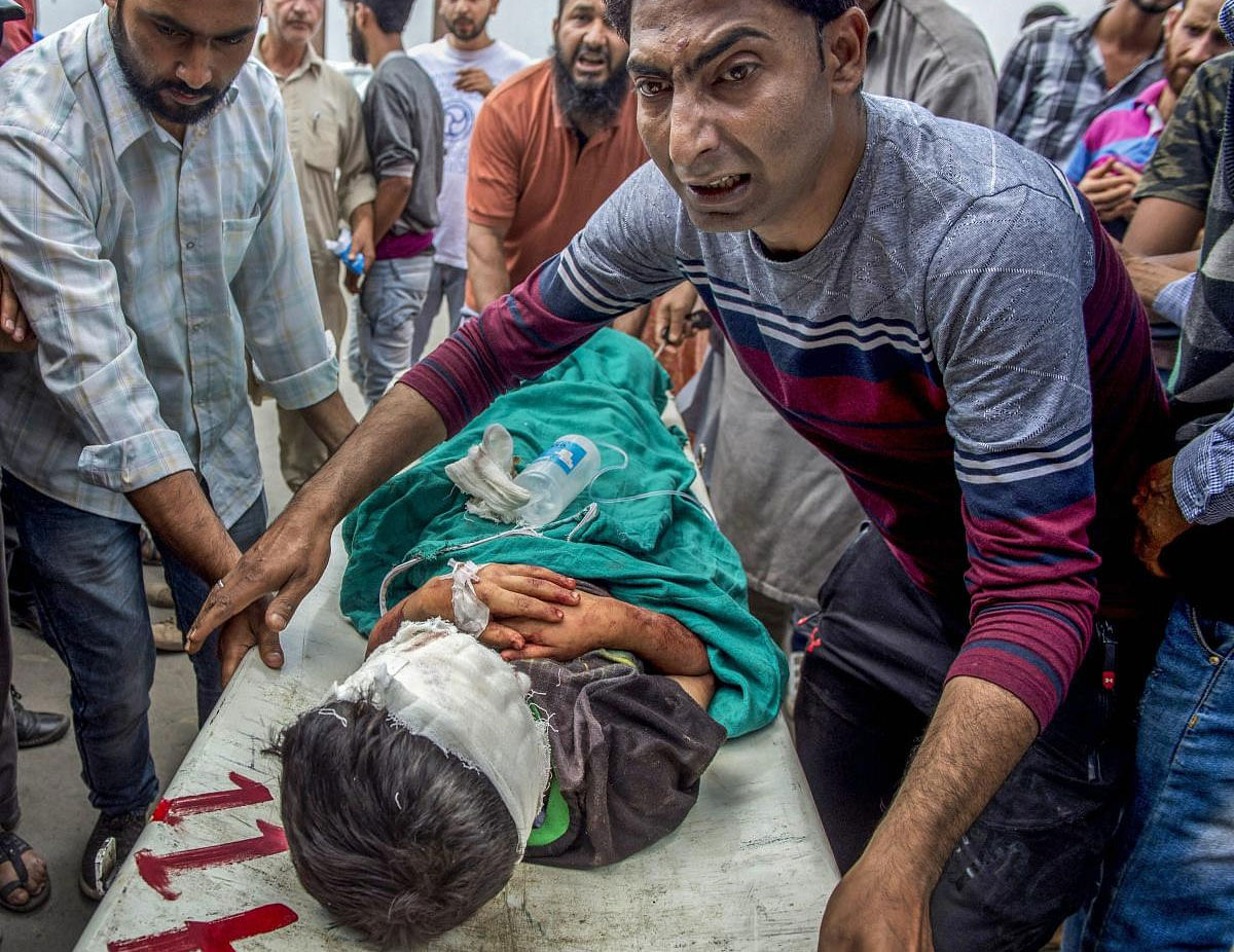 A blast victim being taken for treatment at the SMHS hospital in Shopian on Wednesday, July 11, 2018. The explosion that took place in the residential compound of Khursheed Ahmad Sheikh at Meemandar, killed a boy inside a residential compound and also resulted in injuries to five children, all aged between six and eight years. PTI Photo