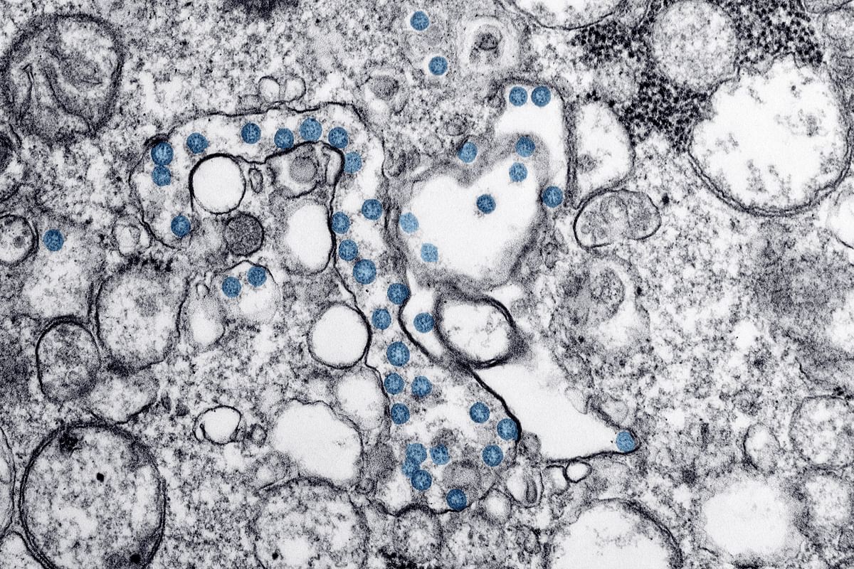 An isolate from the first U.S. case of COVID-19, formerly known as 2019-nCoV or novel coronavirus, is seen in a transmission electron microscopic image obtained from the Centers for Disease Control (CDC) in Atlanta, Georgia, U.S. (Credit: Reuters)