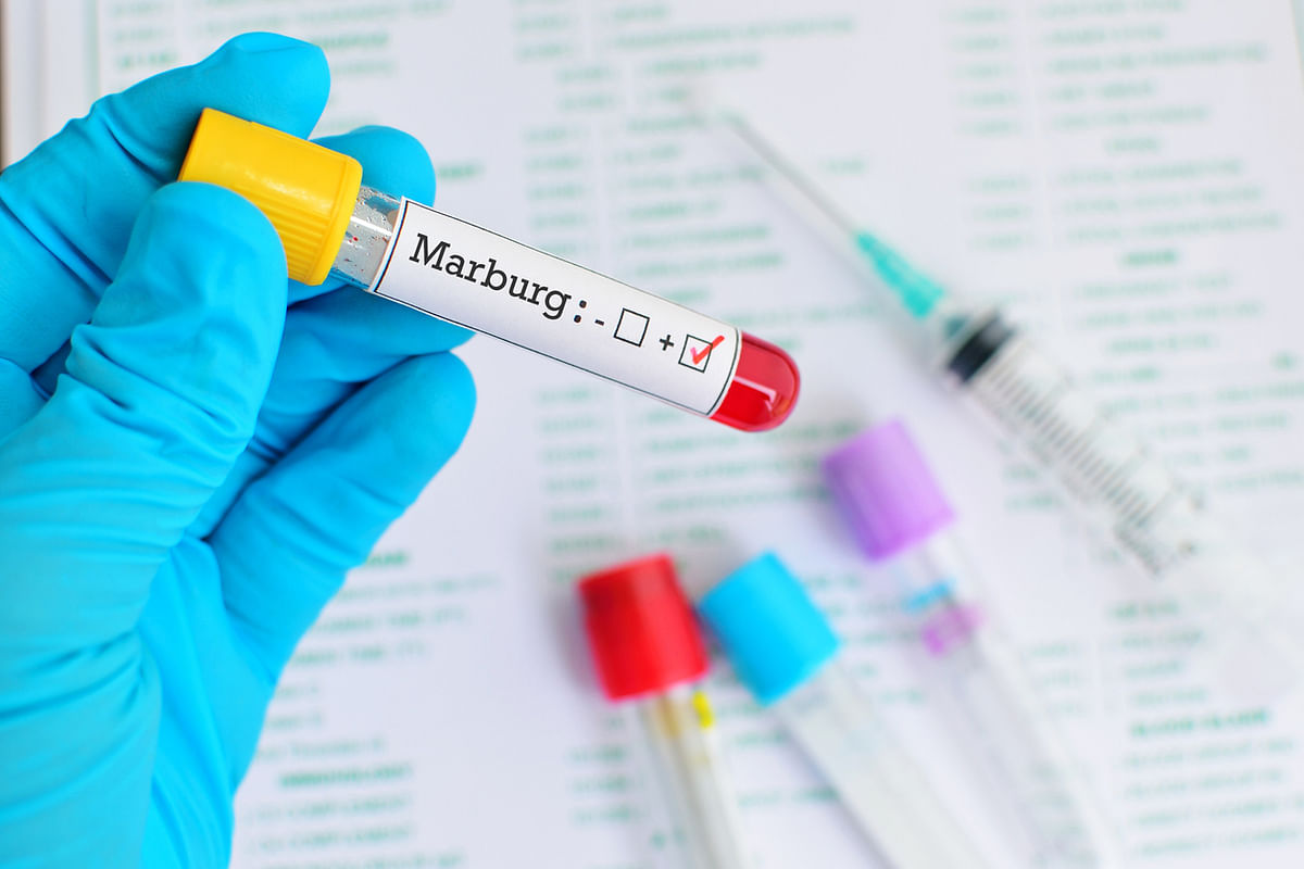 Marburg virus (1967) | Fatality rate: 80% | Credit: iStock Photo