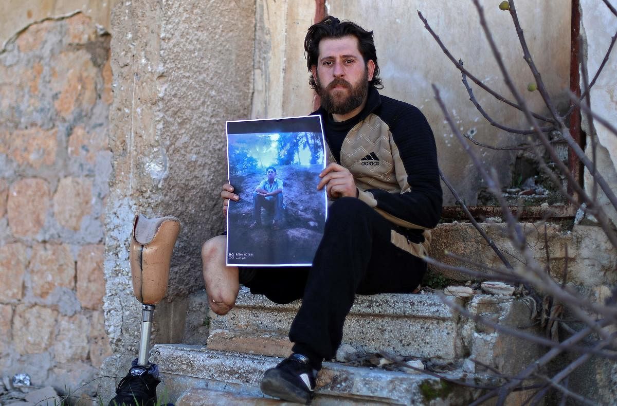 In the last major rebel bastion of Idlib, 29-year-old Bakri al-Debs rests on stone steps with one leg amputated above the knee, his artificial leg resting beside him.  The former medic holds a picture of himself in a similar position at university a decade ago in Latakia where he studied sociology, before he was maimed in what he says was a government barrel bomb strike.