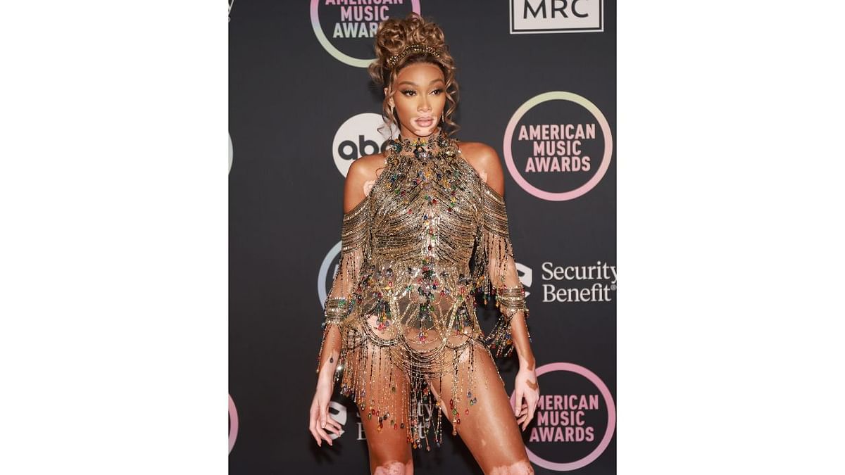 Canadian supermodel Winnie Harlow turned heads with a bejewelled mini dress. Credit: Reuters Photo