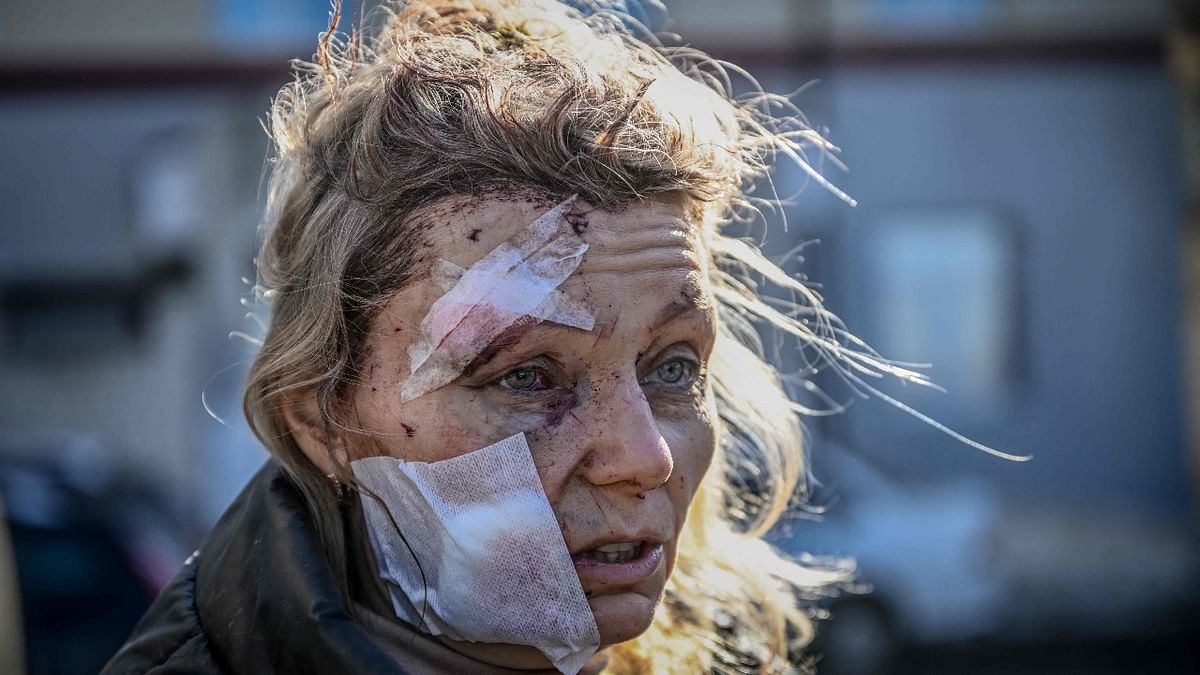A wounded woman stands outside a hospital after the bombing of the eastern Ukraine town of Chuguiv. Credit: AFP Photo