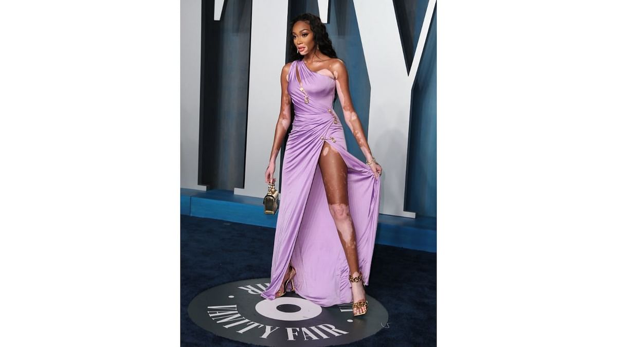 Winnie Harlow left her fans drooling in a thigh-high slit Versace dress. Credit: Reuters Photo