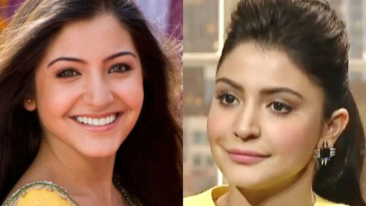 Bollywood actor Anushka Sharma too reportedly had a lip job that didn't go up to the expectations. Anushka was massively trolled the change in her face. Credit: Special Arrangement