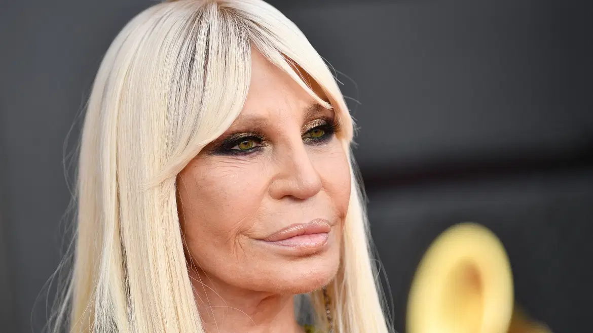 Italian fashion designer Donatella Versace had several cosmetic surgeries, which left her with face completely transformed. AFP Photo