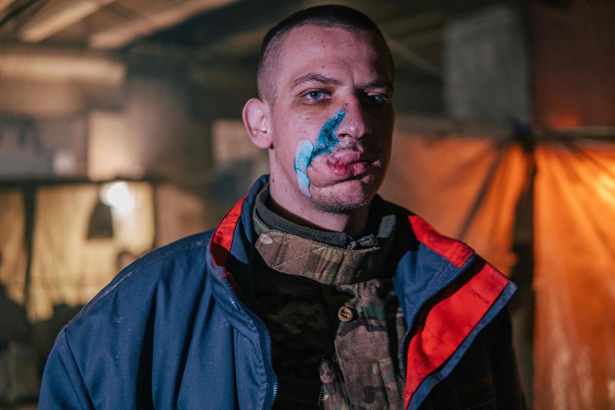 An injured Ukrainian serviceman inside the Azovstal iron and steel works factory in eastern Mariupol, Ukraine, amid the Russian invasion. Credit: AFP Photo
