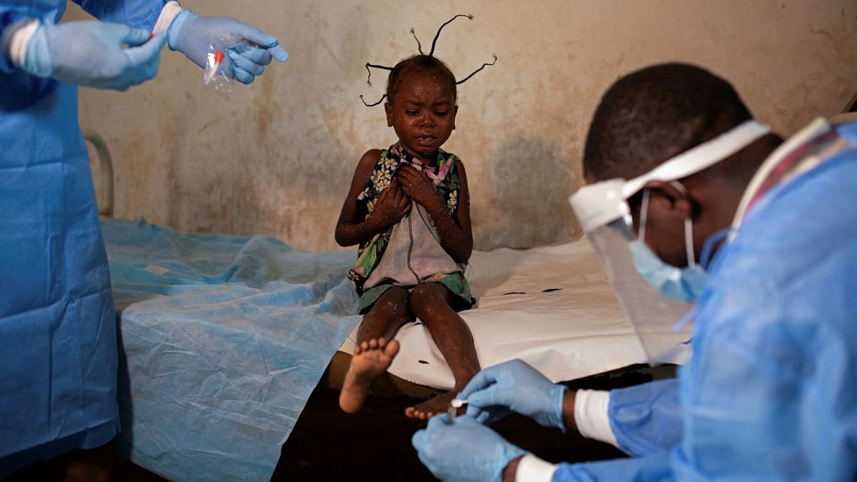 A health official and a nurse collect skin samples from Angelika Lifafu, to test for monkeypox, at the Yalolia health centre, in Tshopo, Democratic Republic of Congo. Credit: Reuters Photo