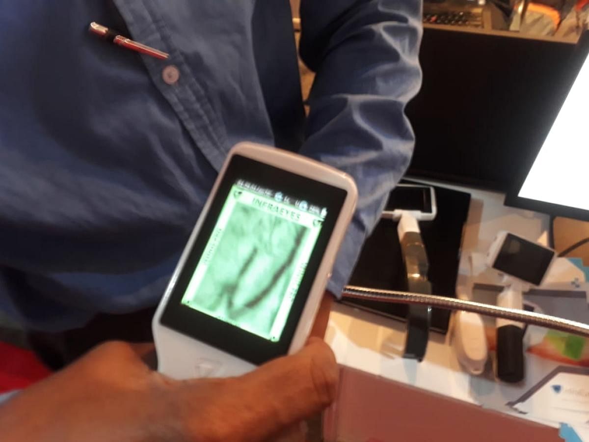 Veins of a person can be seen using the devise developed by InfraEyes at display at the Bengaluru Tech Summit, 2018, on Friday.