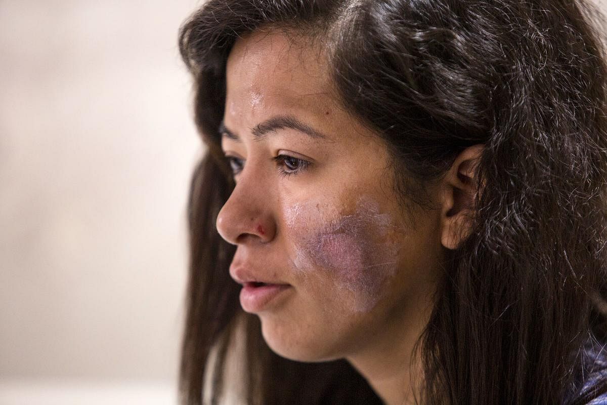 Indian Everest climber Ameesha Chauhan speaks during an interview with AFP at a hospital in Kathmandu on May 27, 2019.