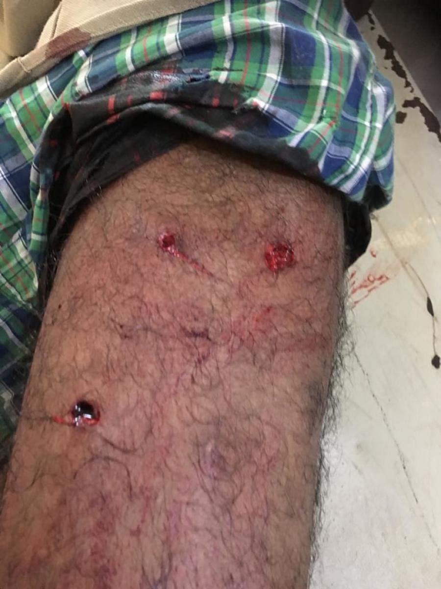 Bite injuries of the tiger on RFO Raghavendra.