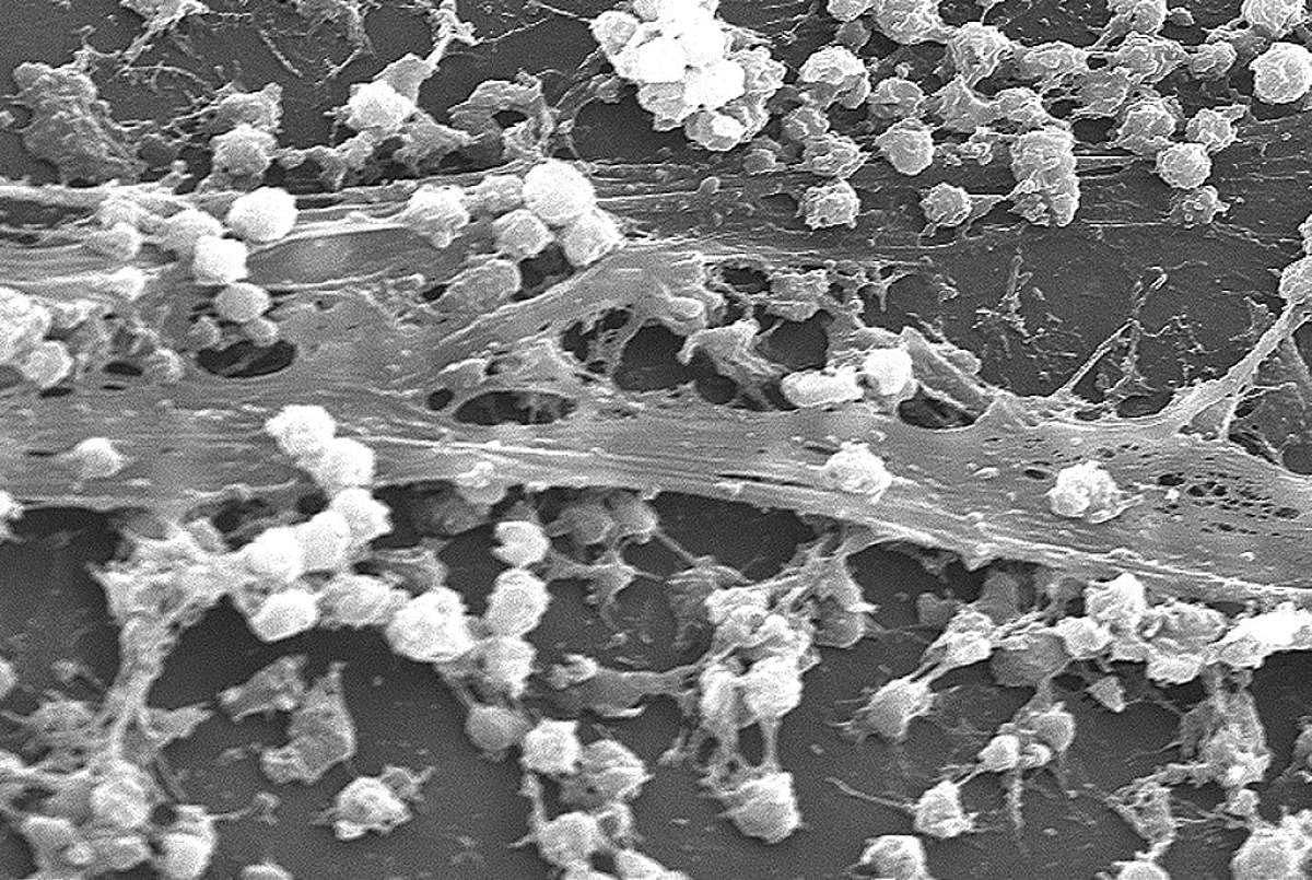 Staphylococcus biofilm. Wikimedia Commons