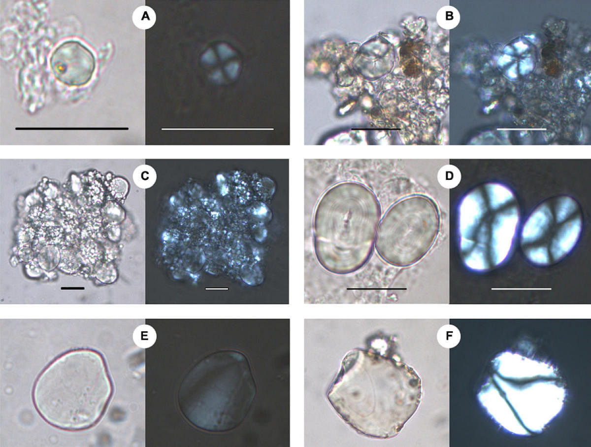 Microscopic images of starch grains observed in the pottery vessels from Datrana, Loteshwar and Shikarpur. (A) A grain of small millet (B) Grain of Job’s tears or adlay millet (C) cluster of wheat or barley grains (D) Grains of pulses (E) Grain of ginge