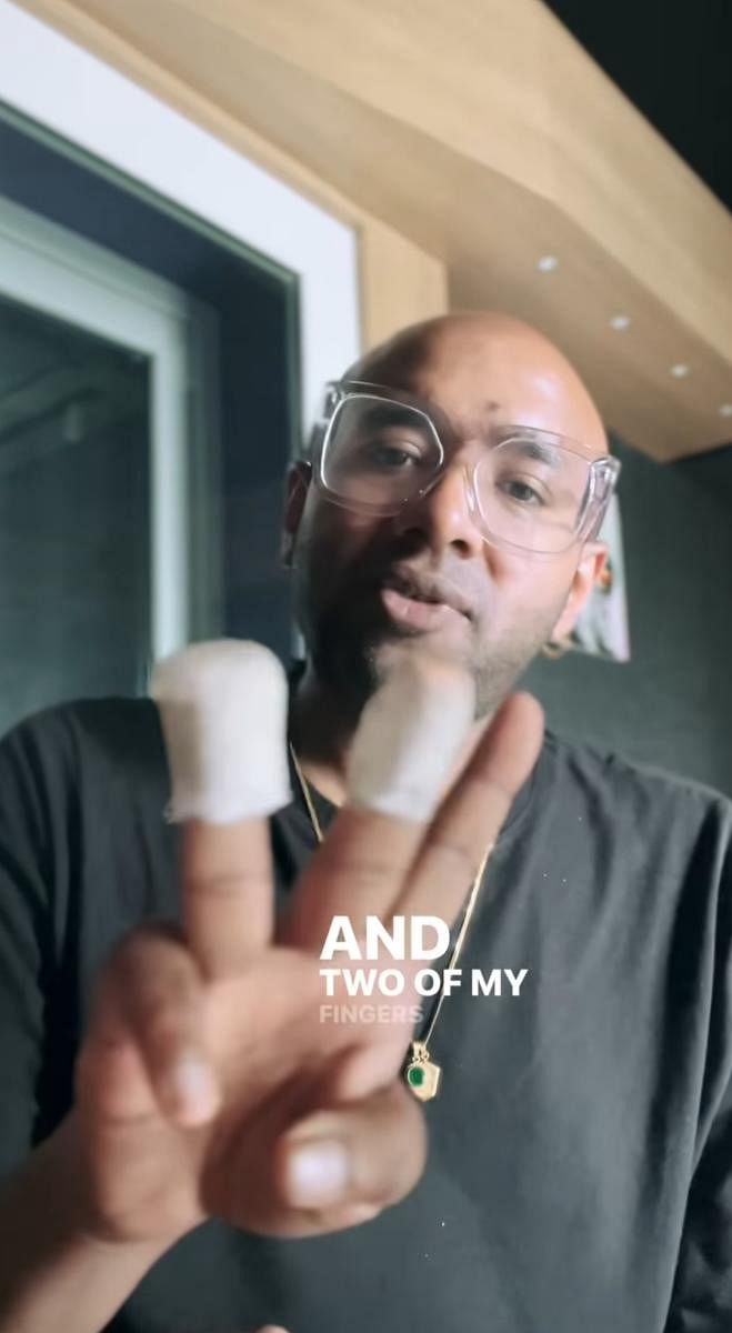 Singer Benny Dayal was injured by a drone while on stage.