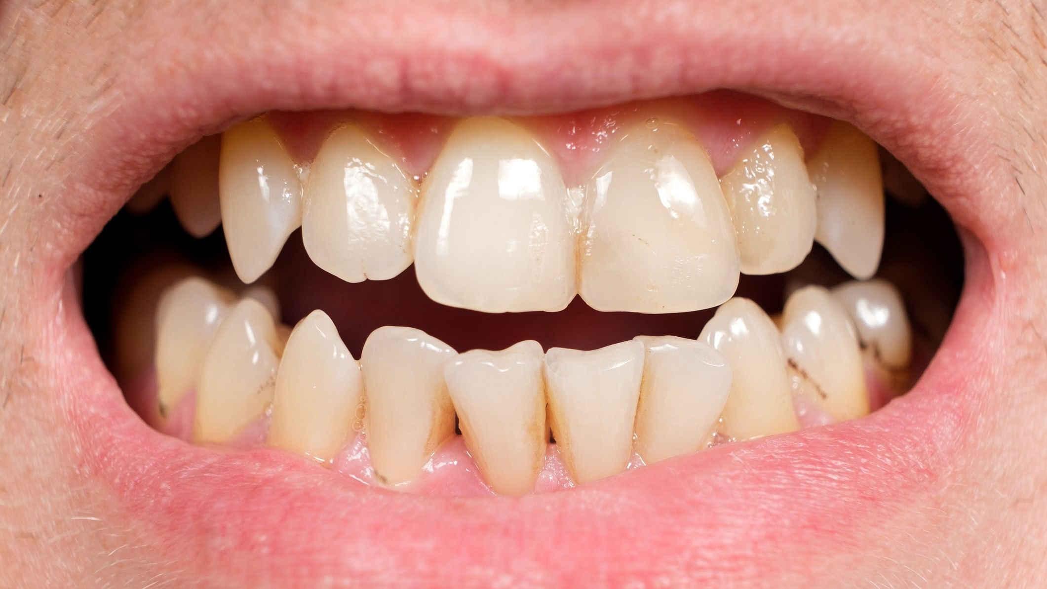 <div class="paragraphs"><p>Representative image showing teeth.</p></div>