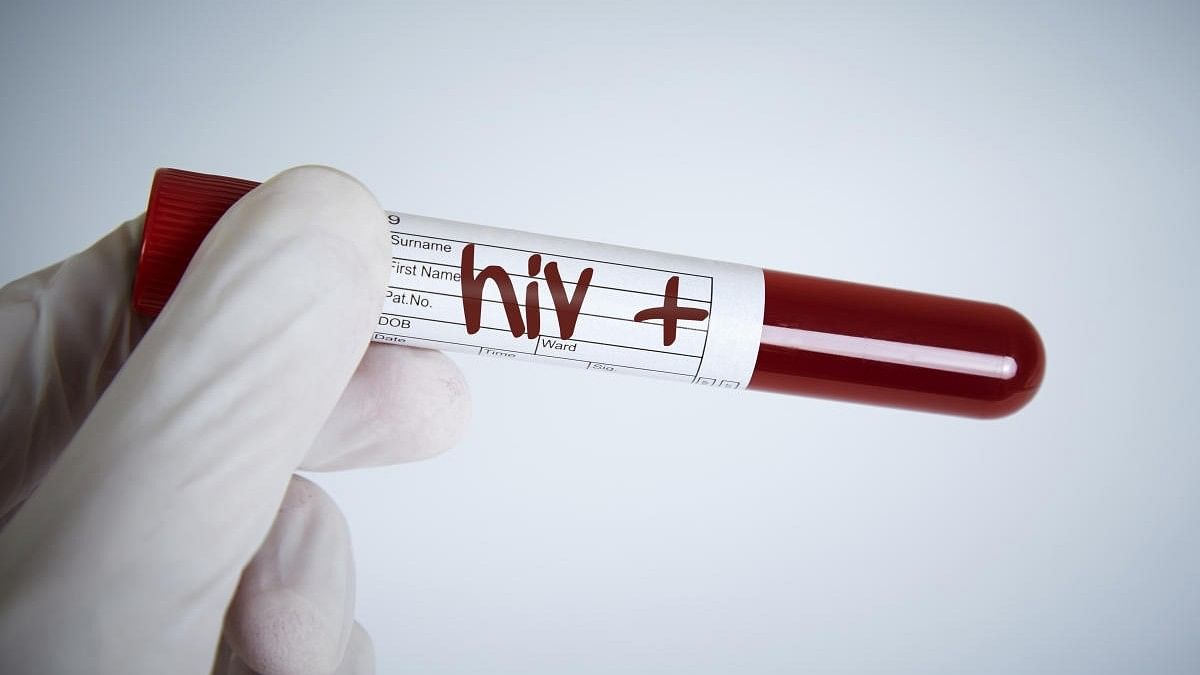 <div class="paragraphs"><p>Representative image of blood sample with HIV+.</p></div>
