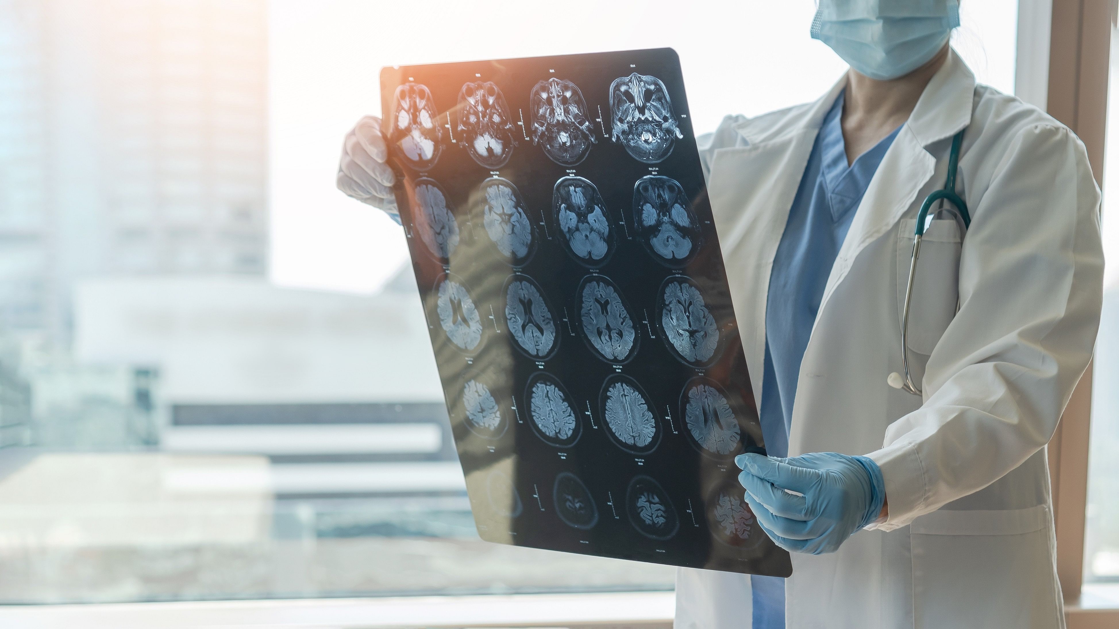 Brain disease diagnosis with medical doctor seeing Magnetic Resonance Imaging (MRI) film 