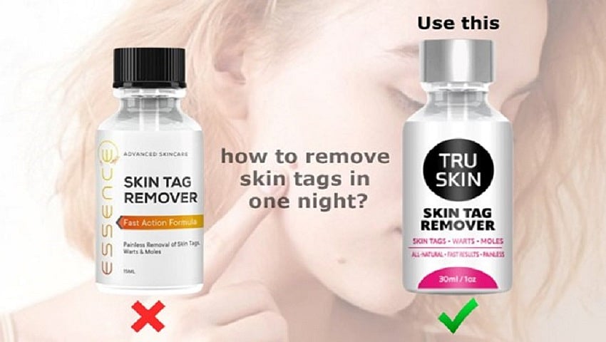 Essence Skin Tag Remover Reviews: Active Ingredients and Effectiveness