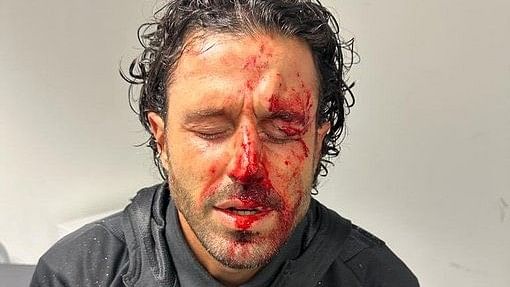 <div class="paragraphs"><p>Olympique Lyonnais coach Fabio Grosso was injured in the attack.</p></div>