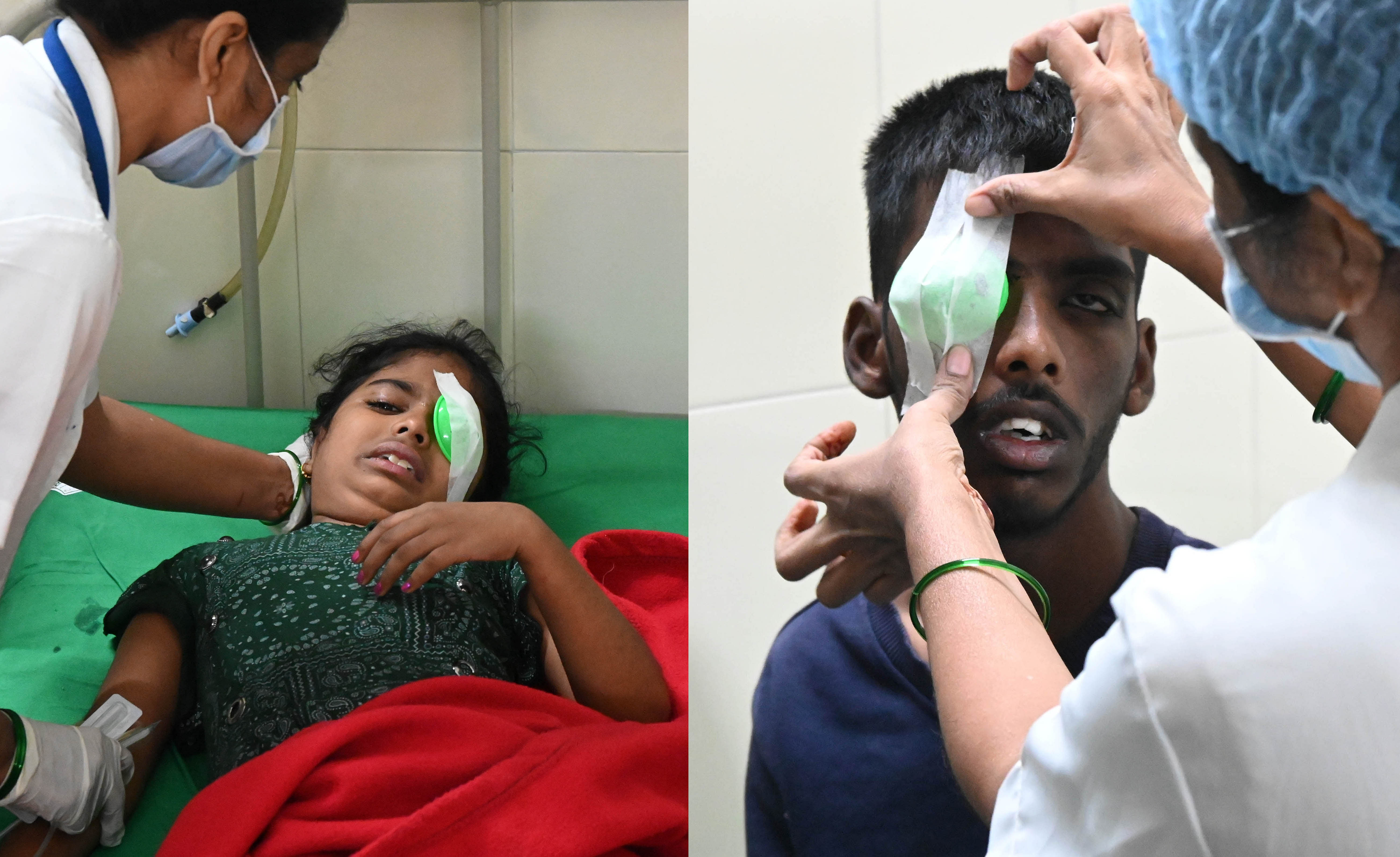 <div class="paragraphs"><p>Two children, Revathi and (R) Ruman, being treated for firecracker-related eye injuries at Minto Hospital on Monday.</p></div>