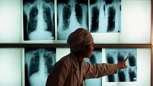 <div class="paragraphs"><p>File Photo: The World Health Organization (WHO) 2023 Global tuberculosis (TB) report also shows that globally, an estimated 10.6 million people fell ill with TB in 2022, up from 10.3 million in 2021.</p></div>