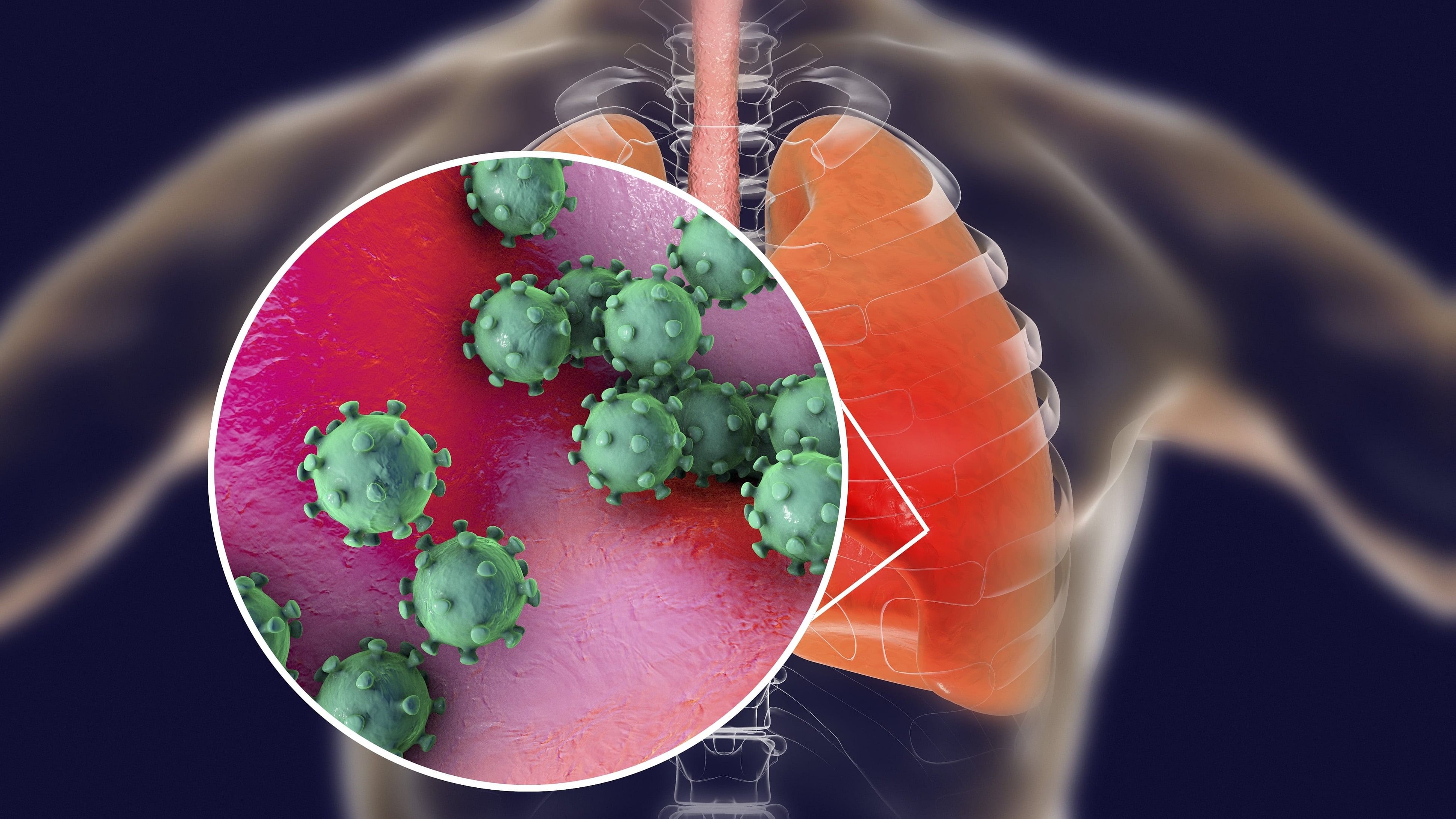 <div class="paragraphs"><p>Infection in the respiratory tract. </p></div>