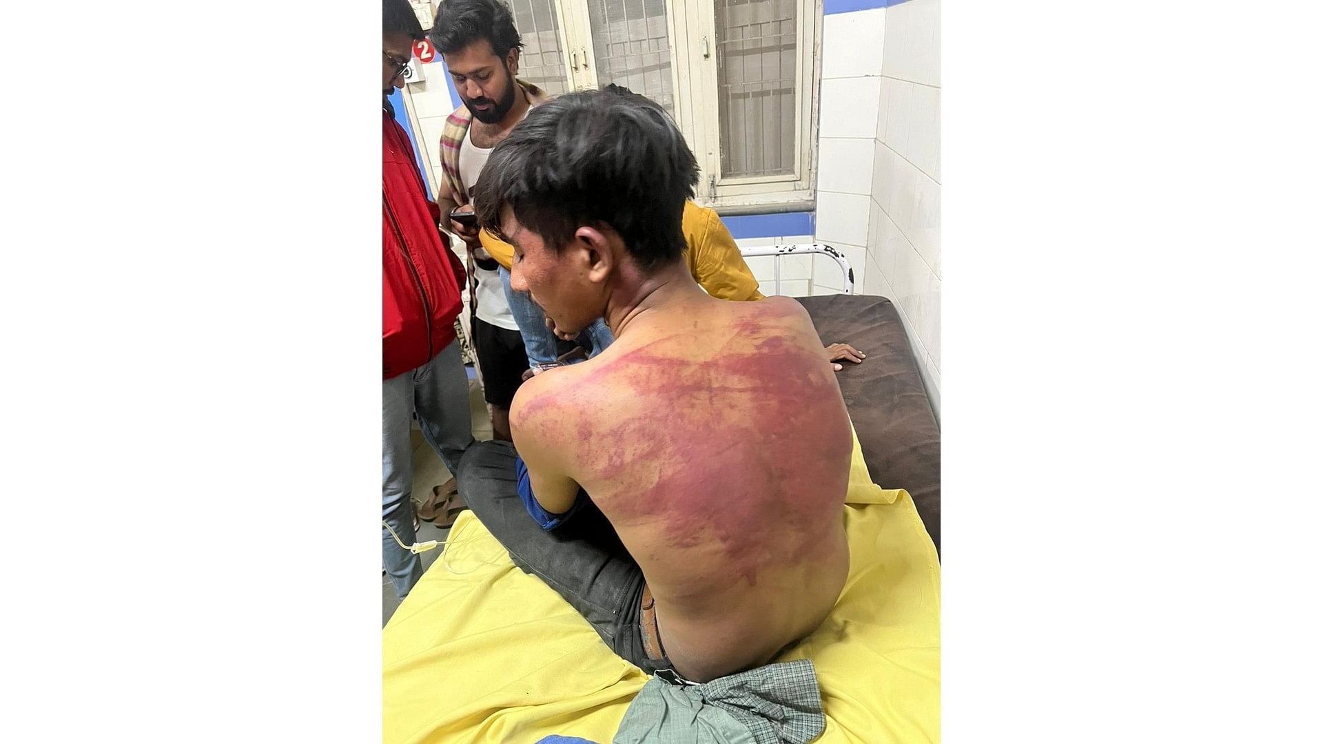 <div class="paragraphs"><p>The victim got himself admitted to GMERS Hospital in Morbi where he is recuperating.</p></div>