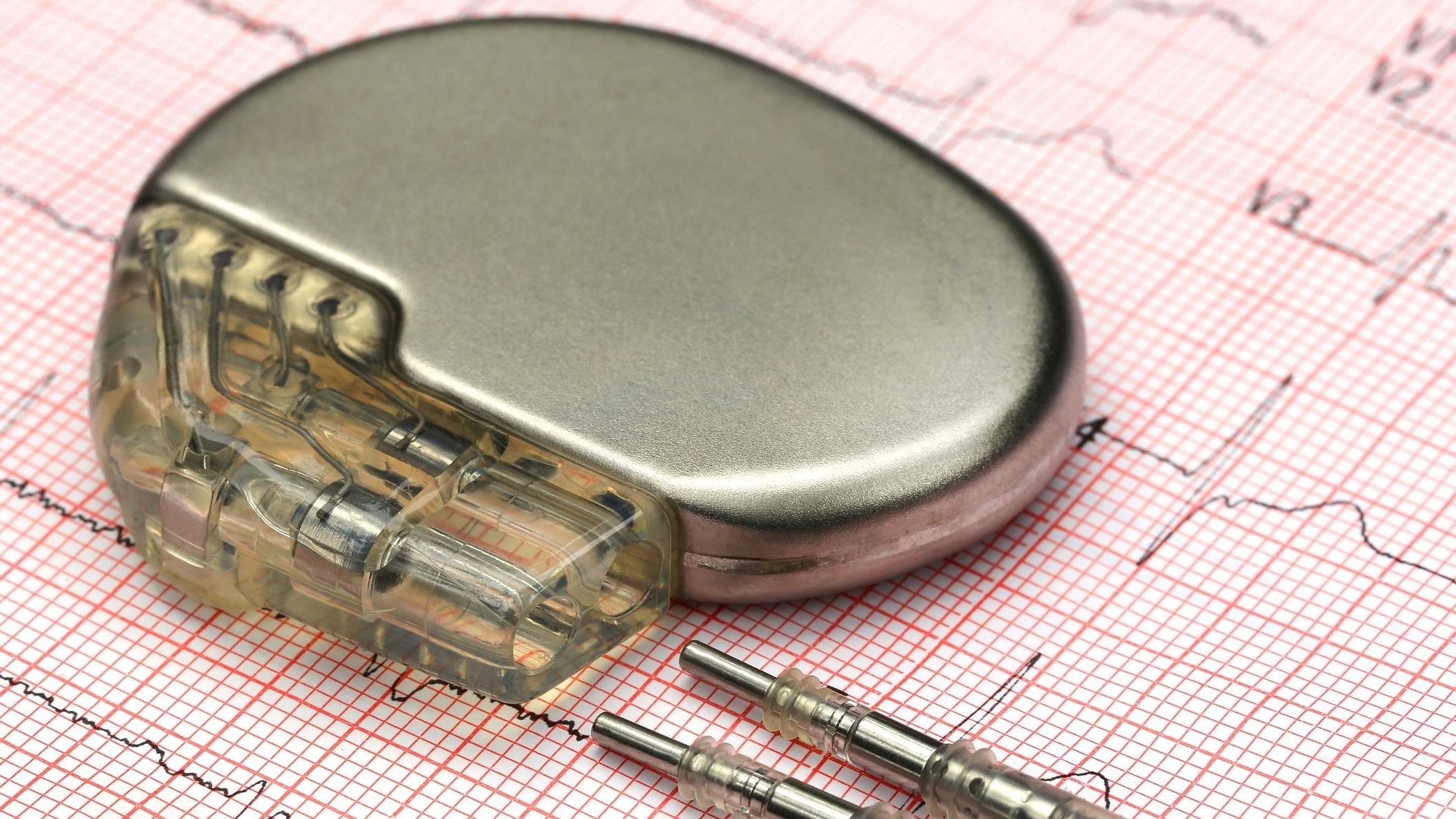 <div class="paragraphs"><p>Representative image of a pacemaker.&nbsp;</p></div>