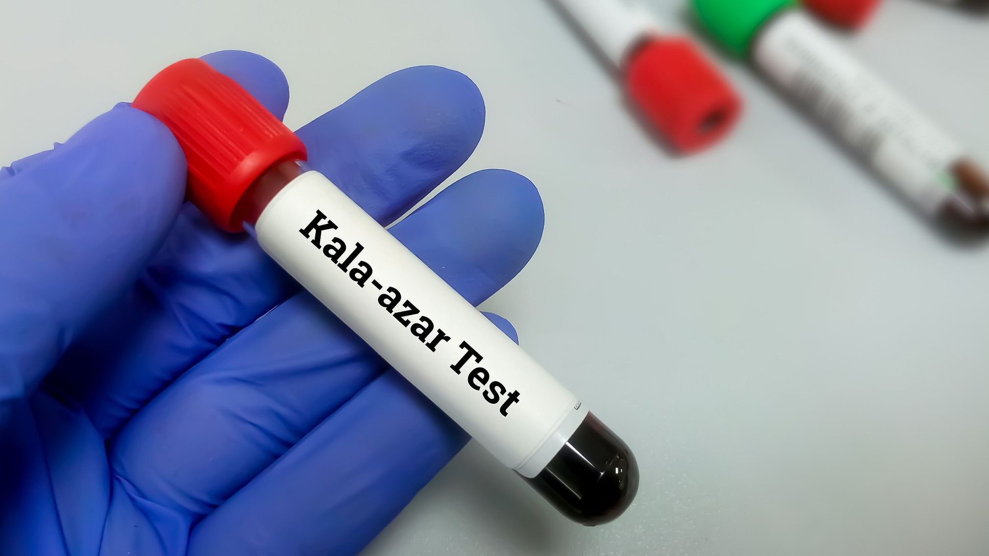 <div class="paragraphs"><p>Representative image of a vial to be used for Kala-Azar test.</p></div>