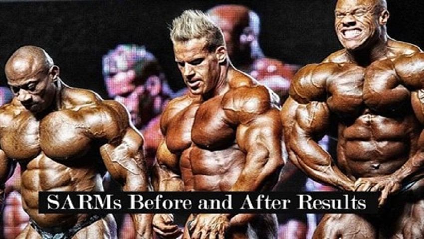 SARMs Before And After Real Results Of Users With Popular SARMs