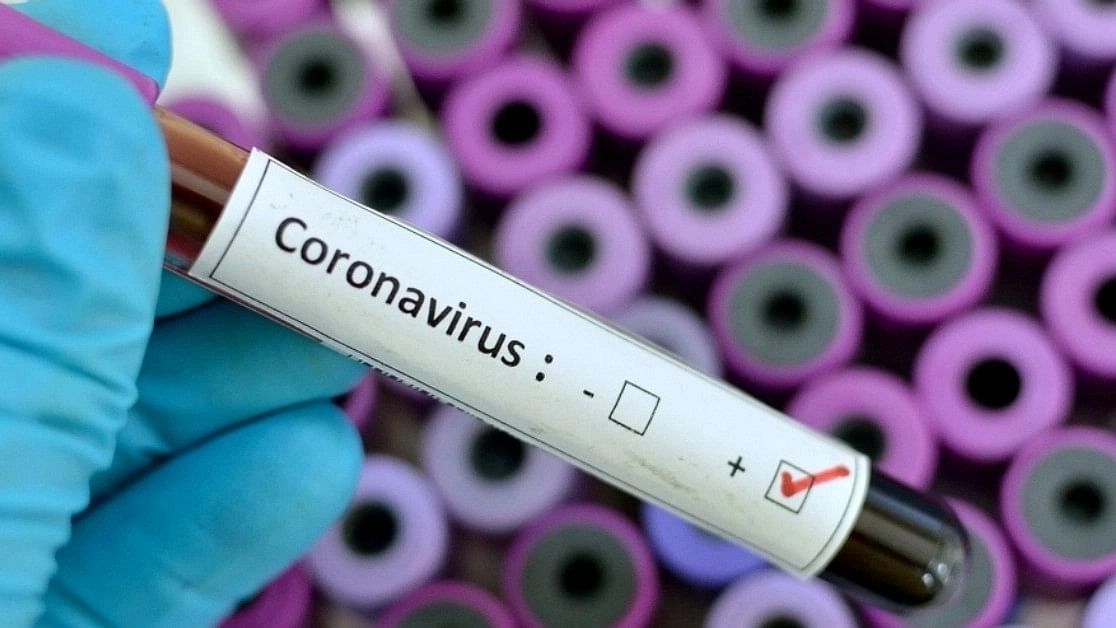 <div class="paragraphs"><p>More than 60 million people in Germany have been vaccinated against SARS-CoV-2, a majority of them several times, the researchers said.</p></div>