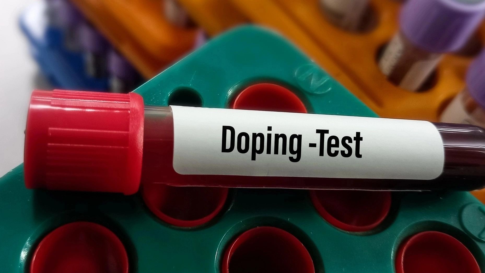 <div class="paragraphs"><p>Representative image of a dope test.</p></div>